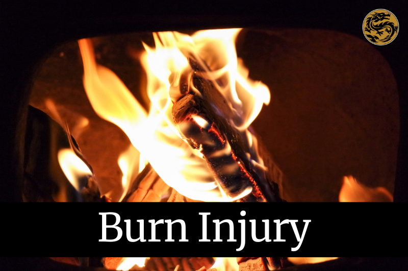 Burn Injury Lawyers in Chico, California